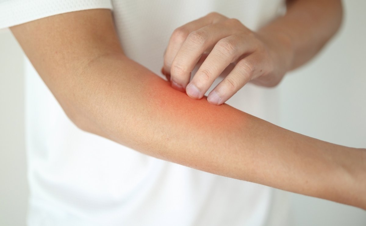 ¿Tu Piel Pica Después de Ducharte? La Calidad del Agua Podría Ser la Causa